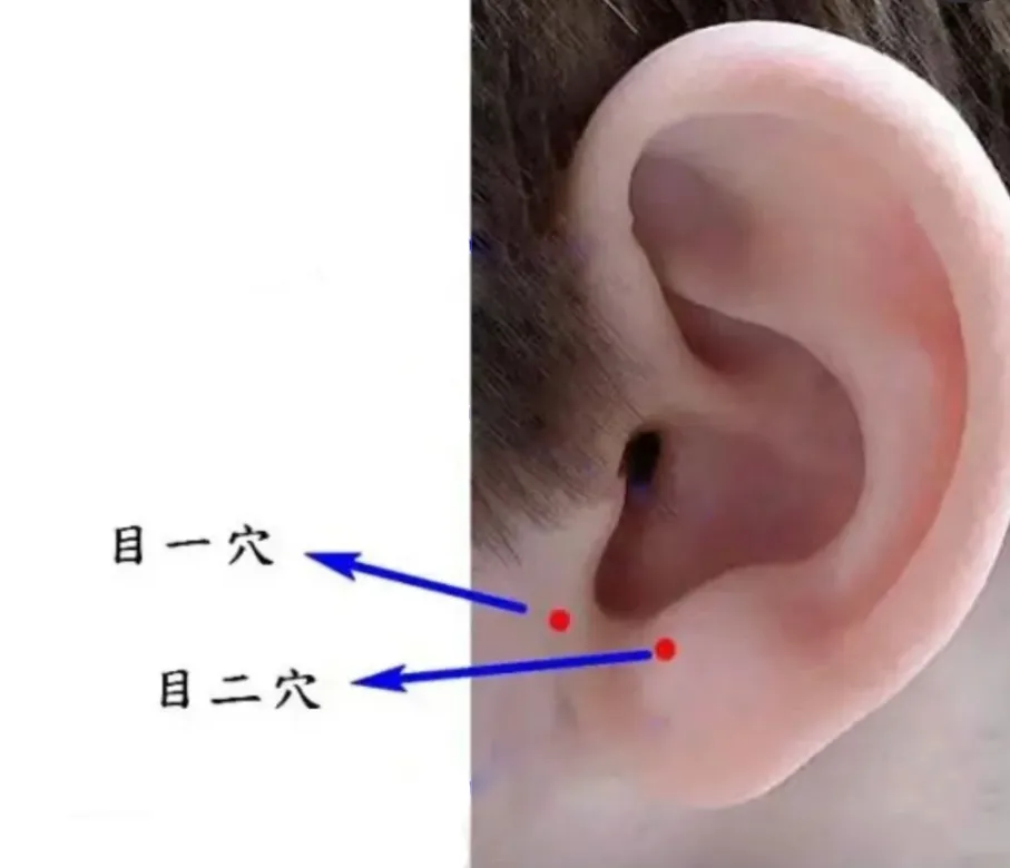 孩子视力差别只盯屏幕!肝脾肾失调才是根源,5 个中医护眼方收好