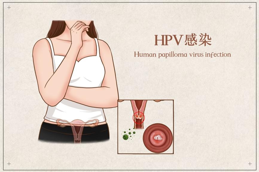 关于 HPV，你需要知道这些！